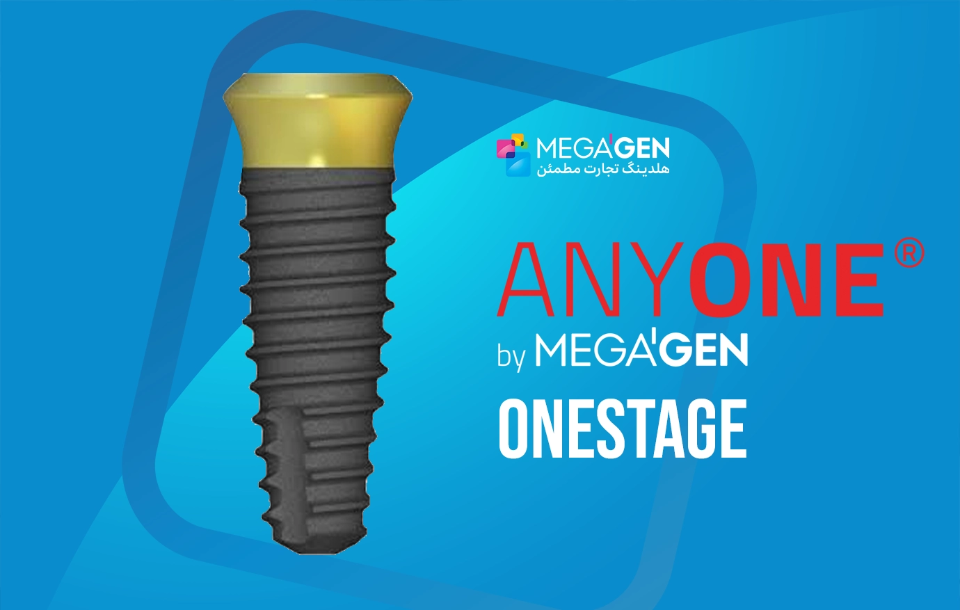 AnyOne-OneStage-Sabadent