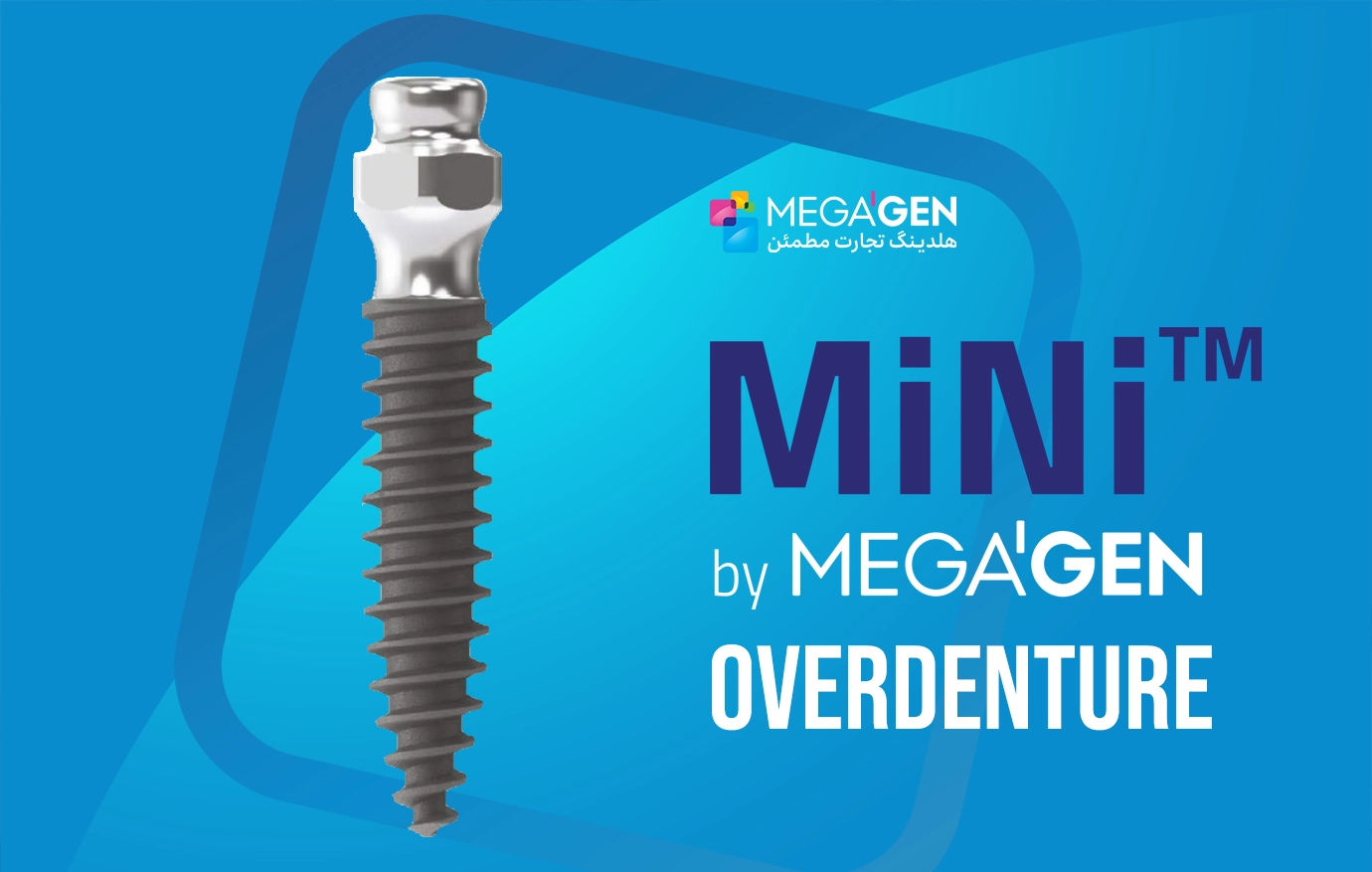 MiNi-overdenture-Sabadent