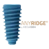 anyridge